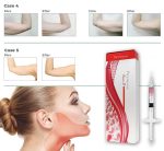 پروسترولین اینر بی مزو ژل لاغری - Image 2