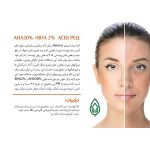 سرم دور چشم کافئین هرموس50میل Hermos - Image 4